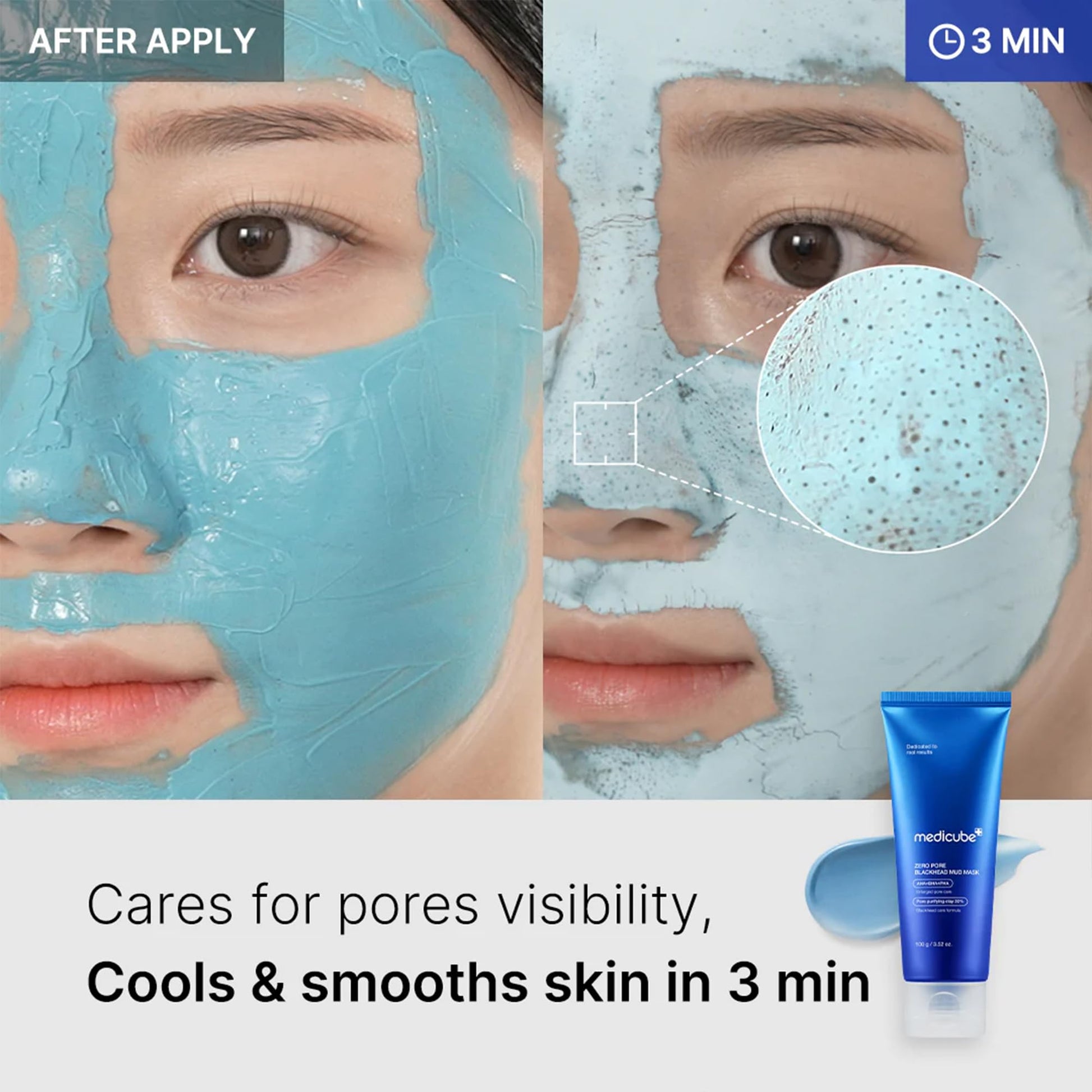 Medicube - Zero Pore Blackhead Mud Mask - San Ha Co